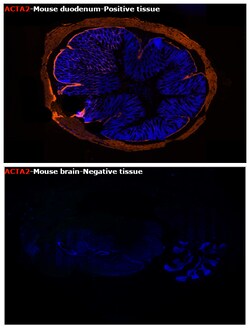 Alpha-Smooth Muscle Actin Monoclonal Antibody (1A4), eFluor 660, eBioscience