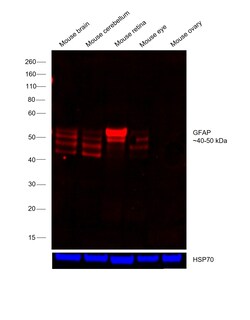 Invitrogen GFAP Monoclonal Antibody (GA5), eFluor 660, eBioscience 25 &mu;g;