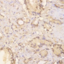 Phosphoserine Monoclonal Antibody (2A4), Abbomax 100 &mu;g; Unconjugated:Antibodies,