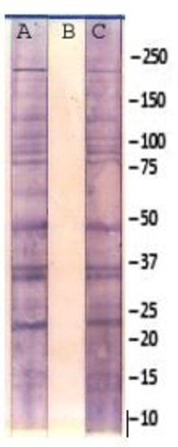 Phosphoserine Monoclonal Antibody (2A4), Abbomax 100 &mu;g; Unconjugated:Antibodies,