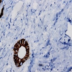 FGFR-3 Polyclonal Antibody, Abbomax 100 &mu;g; Unconjugated:Antibodies,