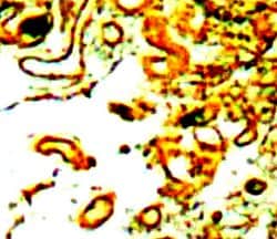 Claudin 10 Polyclonal Antibody, Abbomax 100 &mu;g | Buy Online | Abbomax Inc | Fisher Scientific