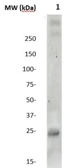 Claudin 10 Polyclonal Antibody, Abbomax 100 &mu;g | Buy Online | Abbomax Inc | Fisher Scientific