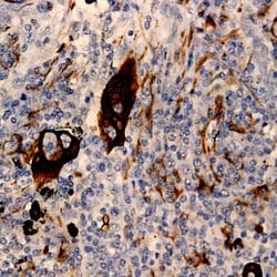 CaM Kinase IV Polyclonal Antibody, Abbomax 100 &mu;g; Unconjugated:Antibodies,
