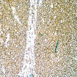 CD20 Monoclonal Antibody (C273), Abbomax 100 &mu;g; Unconjugated:Antibodies,