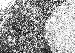 Bcl-2a Monoclonal Antibody (100), Abbomax 100 &mu;g; Unconjugated:Antibodies,