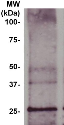 Bcl-2a Monoclonal Antibody (100), Abbomax 100 &mu;g; Unconjugated:Antibodies,