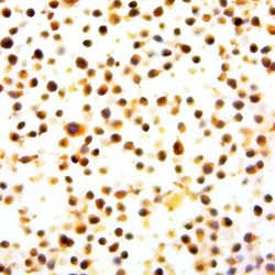 Phospho-NFkB-p100/p52 (Ser869) Polyclonal Antibody, Abbomax 100 &mu;g;