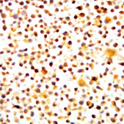 Phospho-NFkB-p65 (Thr435) Polyclonal Antibody, Abbomax 100 &mu;g; Unconjugated:Antibodies,
