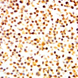 Phospho-NF-kB p105/p50 (Ser893) Polyclonal Antibody, Abbomax 100 &mu;g;