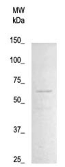 Phospho-NF-kB p65 (Thr254) Polyclonal Antibody, Abbomax 100 &mu;g; Unconjugated:Antibodies,