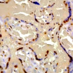 Phospho-IGF-1R (Tyr1161) Polyclonal Antibody, Abbomax 100 &mu;g; Unconjugated:Antibodies,