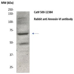 Annexin VI Polyclonal Antibody, Abbomax 100 &mu;g | Buy Online | Abbomax Inc | Fisher Scientific