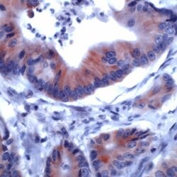 IRS-1 Polyclonal Antibody, Abbomax 100 &mu;g; Unconjugated:Antibodies,