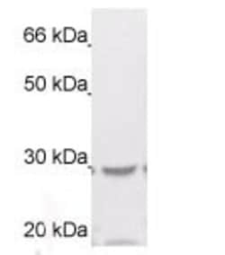 14-3-3 zeta Polyclonal Antibody, Abbomax 100 &mu;g; Unconjugated:Antibodies,