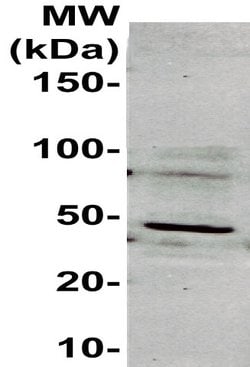 Cytokeratin 20 Polyclonal Antibody, Abbomax 100 &mu;g; Unconjugated:Antibodies,
