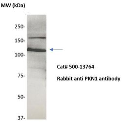 PKN Polyclonal Antibody, Abbomax 100 &mu;g; Unconjugated:Antibodies, Polyclonal