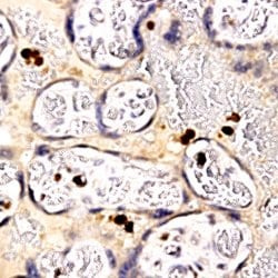 PLAP Polyclonal Antibody, Abbomax 100 &mu;g; Unconjugated:Antibodies, Polyclonal