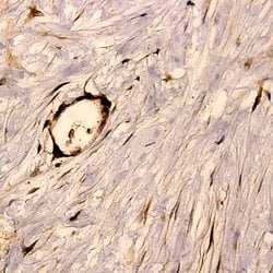 GluR4 Polyclonal Antibody, Abbomax 100 &mu;g; Unconjugated:Antibodies,