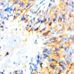 GluR 2/3 Polyclonal Antibody, Abbomax 100 &mu;g; Unconjugated:Antibodies,