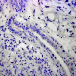 Bak Polyclonal Antibody, Abbomax 100 &mu;g; Unconjugated:Antibodies, Polyclonal