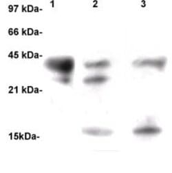 TGF beta Polyclonal Antibody, Abbomax 100 &mu;g; Unconjugated:Antibodies,