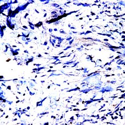 MMP-23 Polyclonal Antibody, Abbomax 100 &mu;g; Unconjugated:Antibodies,