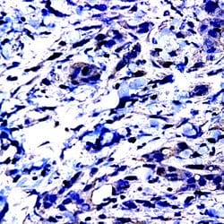 MMP-15 Polyclonal Antibody, Abbomax 100 &mu;g; Unconjugated:Antibodies,