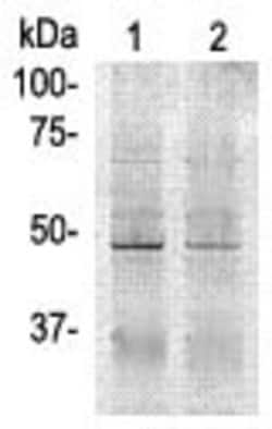Actin-beta Polyclonal Antibody, Abbomax 100 &mu;g; Unconjugated:Antibodies,