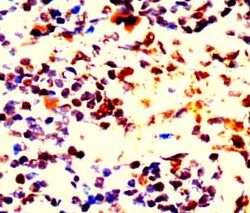 BCL-2 Polyclonal Antibody, Abbomax 100 &mu;g; Unconjugated:Antibodies,