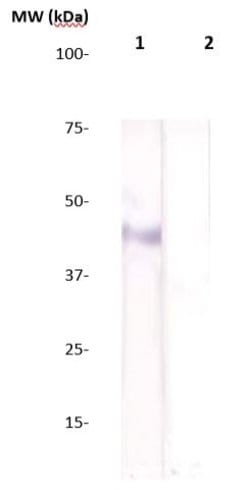 Estrogen Receptor beta (ER beta) Polyclonal Antibody, Abbomax 100 &mu;g;