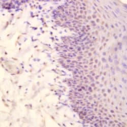 Myosin Heavy Chain, (Smooth Muscle) Monoclonal Antibody (ABM201), Abbomax