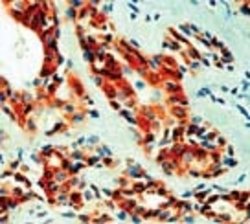 Vacular Endothelial Growth Factor (VEGF) Monoclonal Antibody (ABM225),