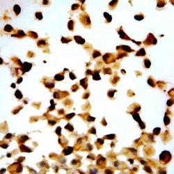 p57 /Kip2 Monoclonal Antibody (KP10), Abbomax 100 &mu;g | Buy Online | Abbomax Inc | Fisher Scientific