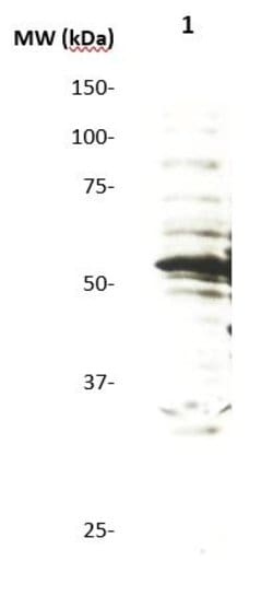 p57 /Kip2 Monoclonal Antibody (KP10), Abbomax 100 &mu;g | Buy Online | Abbomax Inc | Fisher Scientific