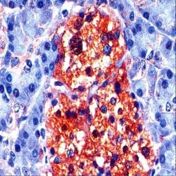 Neuron Specific Enolase (NSE) Monoclonal Antibody (ABM347), Abbomax 100