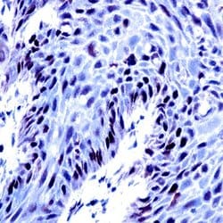Retinoblastoma (RB) Monoclonal Antibody (ABM353), Abbomax 100 &mu;g; Unconjugated:Antibodies,