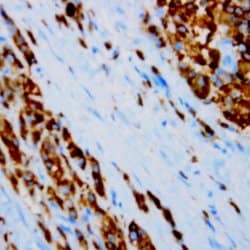S100 Monoclonal Antibody (15E2E2), Abbomax 100 &mu;g; Unconjugated:Antibodies,