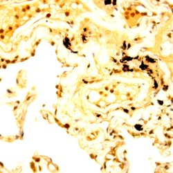 Raf -A Polyclonal Antibody, Abbomax 100 &mu;g; Unconjugated:Antibodies,