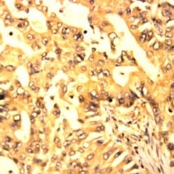 Glycogen Synthase Kinase 3b (GSK3b) Polyclonal Antibody, Abbomax 100 &mu;g;