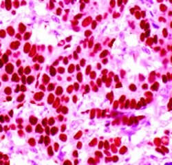 Heat Shock Factor 1 Monoclonal Antibody (ABM401), Abbomax 100 &mu;g; Unconjugated:Antibodies,