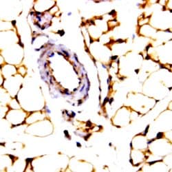 JNK Activating kinase (JKK1) Polyclonal Antibody, Abbomax 100 &mu;g; Unconjugated:Antibodies,