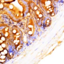 Mekk-1 Polyclonal Antibody, Abbomax 100 &mu;g; Unconjugated:Antibodies,