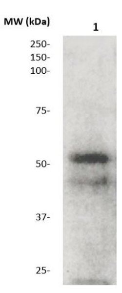 MMP-1 (Collagenase-I) Polyclonal Antibody, Abbomax 100 &mu;g | Buy Online | Abbomax Inc | Fisher Scientific