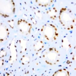 CIS-1 Polyclonal Antibody, Abbomax 100 &mu;g | Buy Online | Abbomax Inc | Fisher Scientific