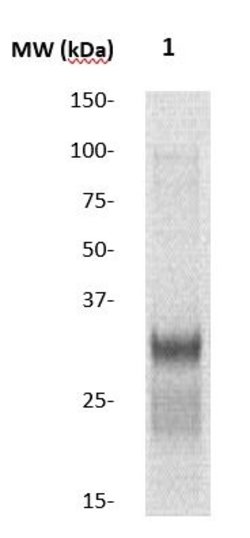 CIS-1 Polyclonal Antibody, Abbomax 100 &mu;g | Buy Online | Abbomax Inc | Fisher Scientific