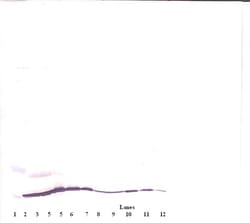 Invitrogen Eotaxin Monoclonal Antibody, PeproTech 500 &mu;g; Unconjugated:Antibodies,