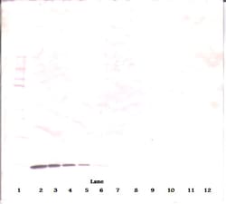 Invitrogen beta-NGF Monoclonal Antibody, PeproTech 500 &mu;g; Unconjugated:Antibodies,
