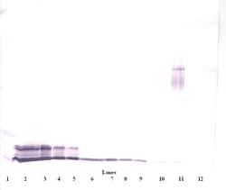 Invitrogen PF4 Polyclonal Antibody, PeproTech , Invitrogen 1 mg; Unconjugated:Antibodies,