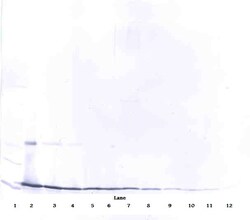 Invitrogen IL-17A Polyclonal Antibody, PeproTech , Invitrogen 100 &mu;g;